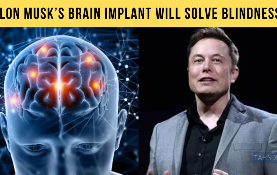 Elon Musks Brain Implant Surgery Tahnix